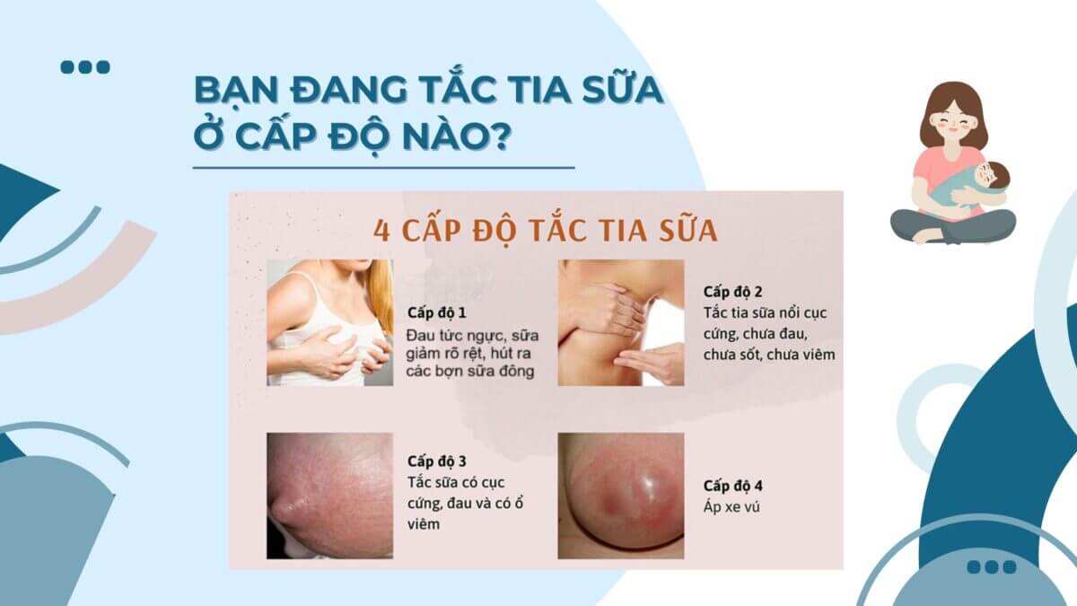 Chua tac tia sua da nang