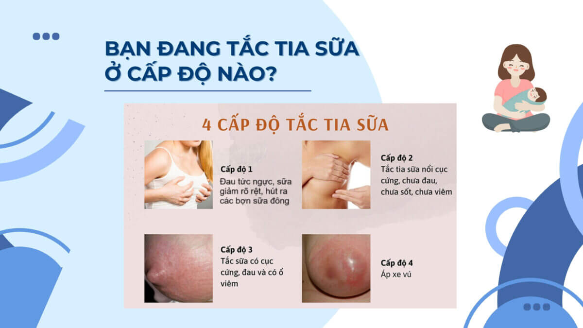 Chua tac tia sua da nang